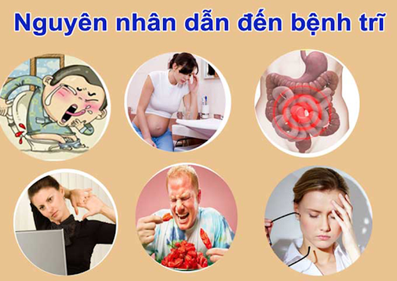 Bệnh trĩ thường gặp ở độ tuổi nào, người trẻ có bị mắc trĩ không? 2