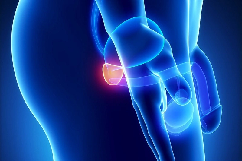 Góc hỏi đáp: Viêm tuyến tiền liệt có tự khỏi không? 1