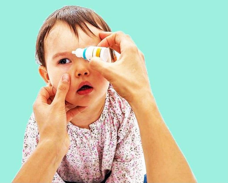 Bệnh viêm kết mạc dị ứng ở trẻ em do đâu 2