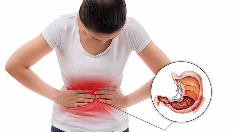 Bệnh viêm loét dạ dày là gì? 1