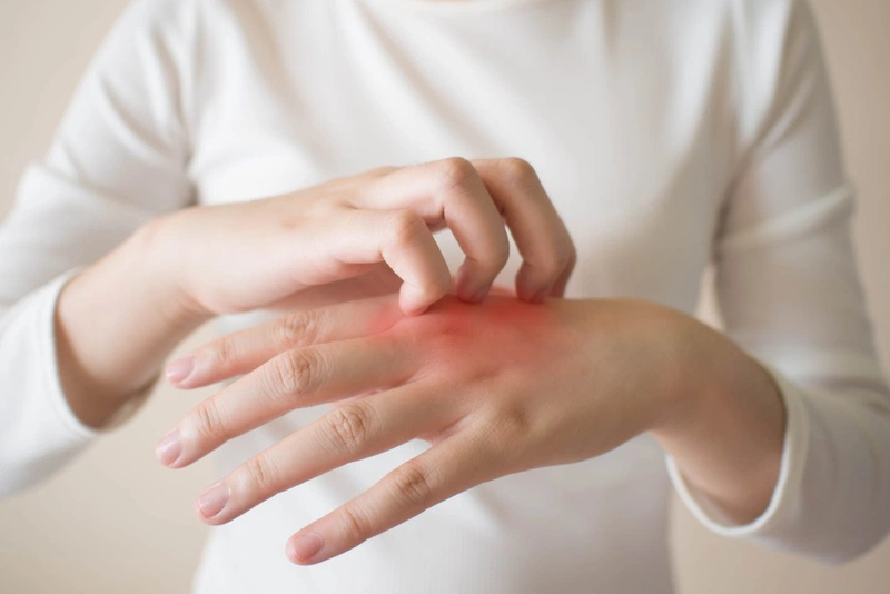 Hướng dẫn điều trị viêm mô tế bào đúng cách 2