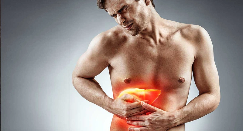 Bệnh vú to ở nam giới: Nguyên nhân và cách điều trị 3