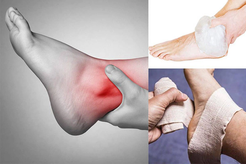 Các chấn thương khi đá bóng mà các cầu thủ hay gặp nhất 1