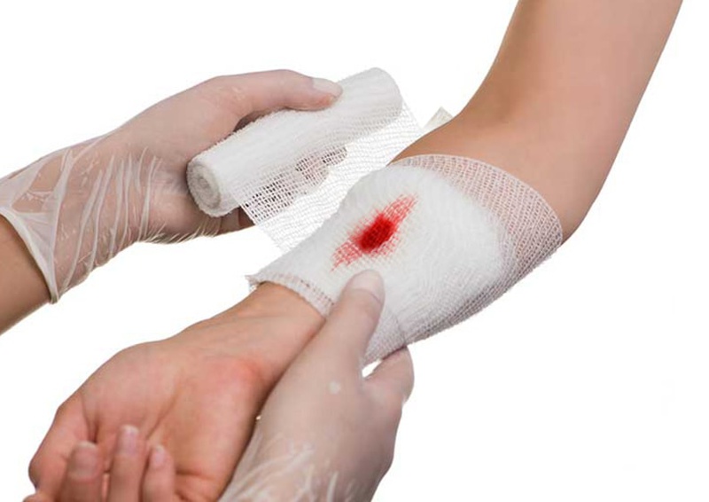 Bị chó cắn và cách sơ cứu chó cắn tại nhà 3