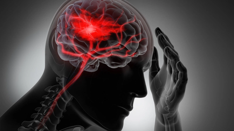 Bị đau đầu thường xuyên là bệnh gì?2