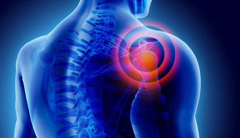 Bị đau khớp bả vai trái nguyên nhân do đâu? Cách khắc phục2