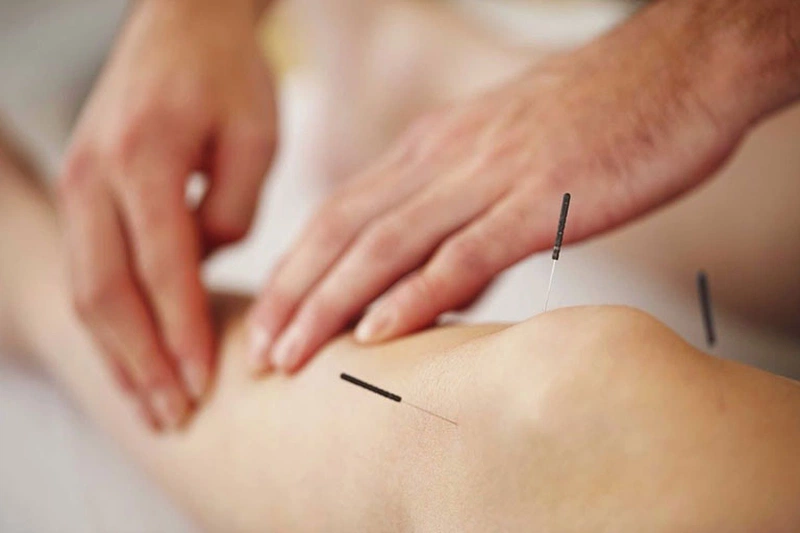 Bị đau khớp gối châm huyệt nào hiệu quả? 3
