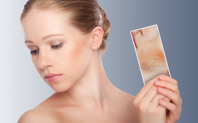 Bị dị ứng yến mạch: Biểu hiện và điều trị như thế nào 3