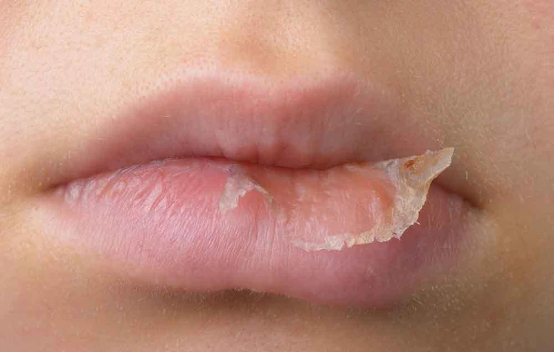 Bí kíp chống lão hóa môi làm cho đôi môi luôn căng mọng 1