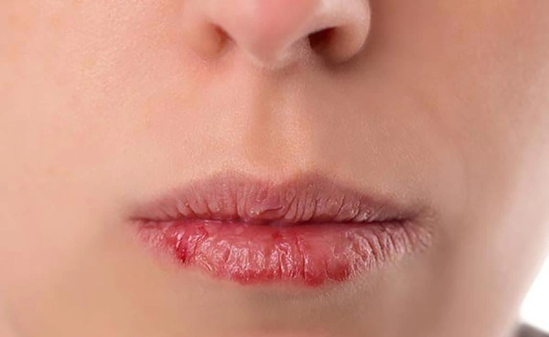 Bí kíp chống lão hóa môi làm cho đôi môi luôn căng mọng 2