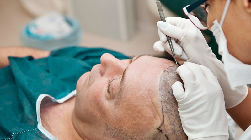 Bí quyết kích thích mọc tóc cho nam giới đến từ Pháp 2