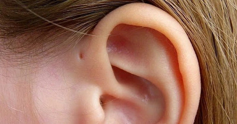 Bị rò luân nhĩ kiêng ăn gì? Những lưu ý khi chăm sóc người bị rò luân nhĩ 1