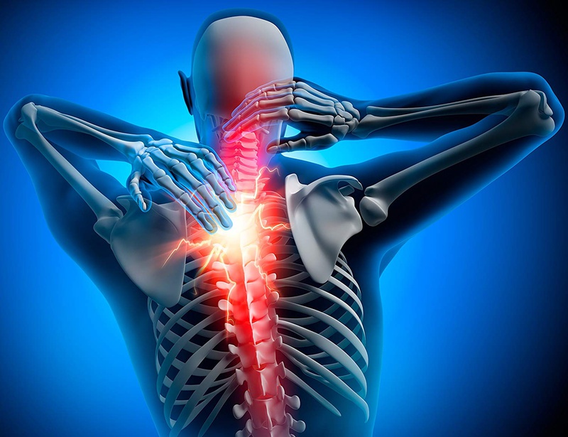 Bị vôi hoá gai cột sống liệu có thể chữa được 2