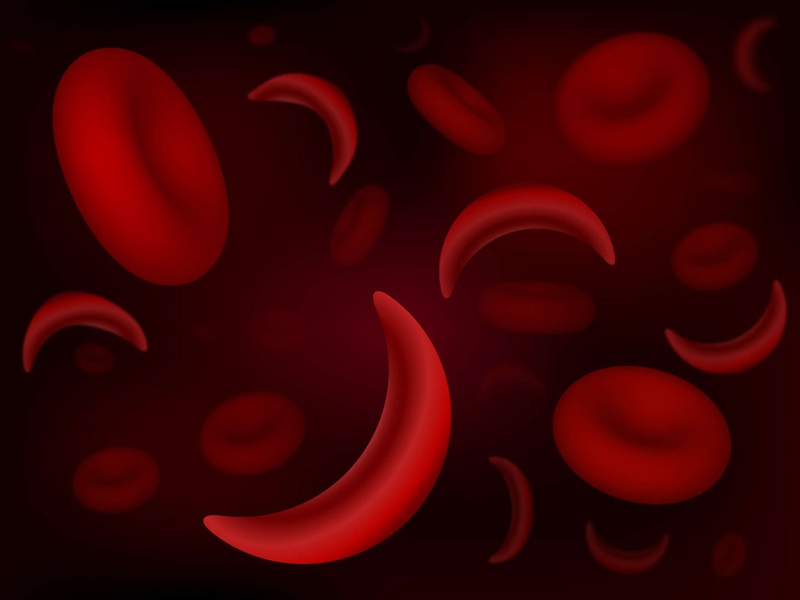 Biến chứng bệnh thiếu máu di truyền và cách để phòng ngừa hiệu quả 1