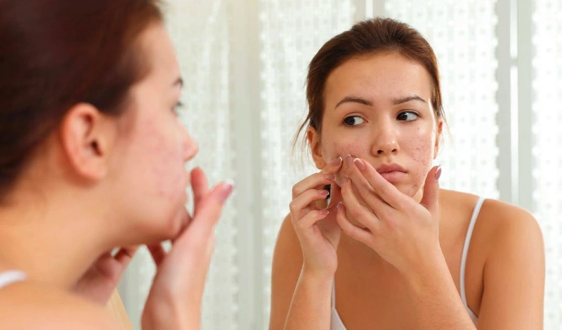 Bôi nghệ tươi qua đêm có tốt không? Cách bôi nghệ đúng chuẩn, an toàn 1