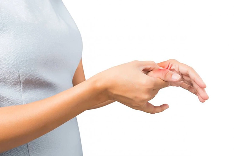 Bong gân ngón cái là gì? Triệu chứng và cách xử lý hiệu quả 2