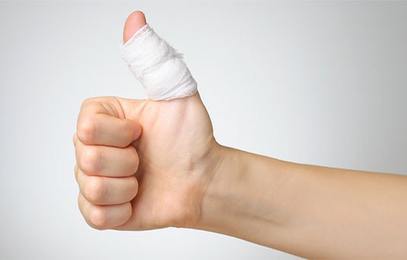 Bong gân ngón cái là gì? Triệu chứng và cách xử lý hiệu quả 3