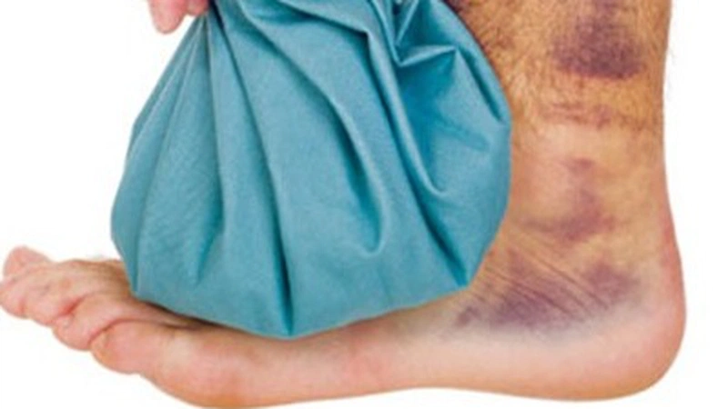 [ GIẢI ĐÁP ] Bong gân xoa mật gấu NÊN hay KHÔNG NÊN? 1