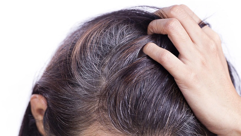 Tiết lộ top 8 loại thuốc trị bạc tóc sớm hiệu quả