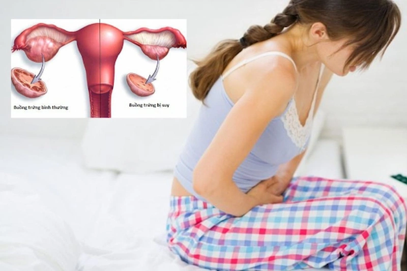 Buồng trứng lão hóa sớm nguy hiểm như thế nào?