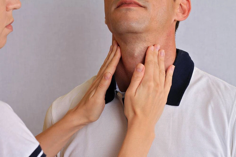Bướu cổ có di truyền không và điều trị thế nào 2