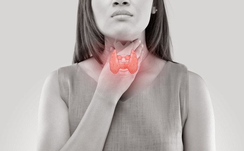 Bướu cổ có vôi hóa nên điều trị thế nào? 1