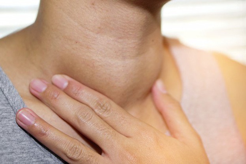 Bướu cổ và ung thư tuyến giáp, những thông tin cần biết 1