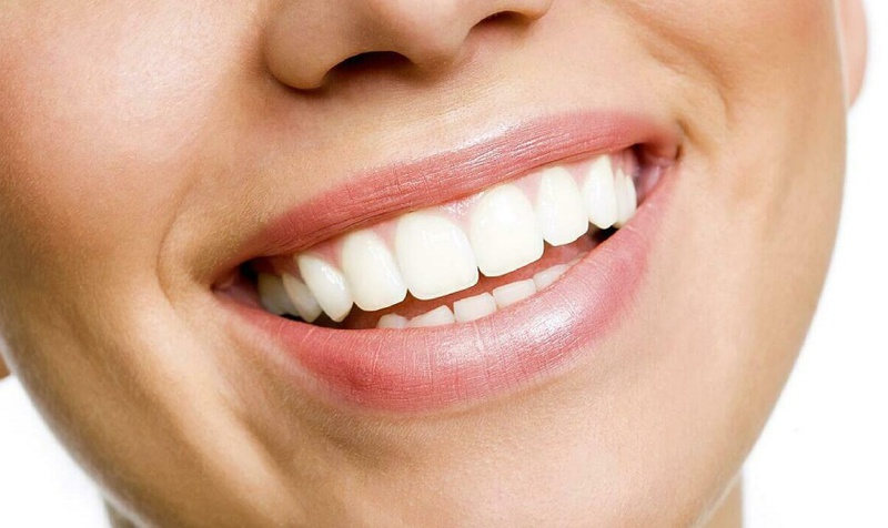 Một số chất làm trắng có thể ảnh hưởng đến độ bền của men răng và khiến răng dễ bị tổn thương