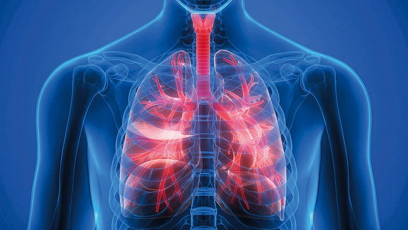 Các bệnh lý về phổi? Phương pháp phẫu thuật phổi hiệu quả 2