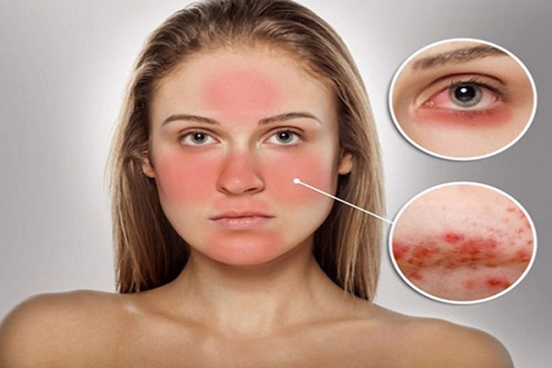 Các bước skincare cho mẹ sau sinh 5
