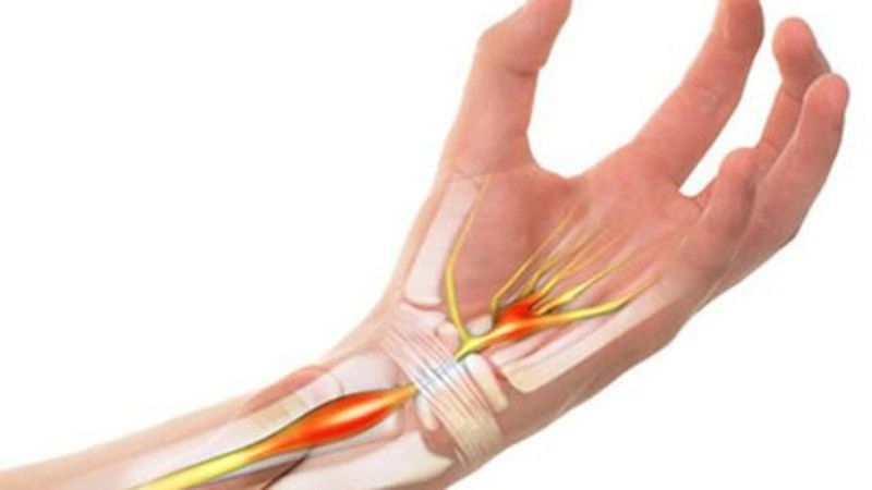 Hướng dẫn sơ cứu dập ngón tay đúng cách 2
