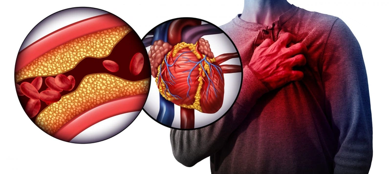 Các bước sơ cứu lên máu nên nắm rõ 4