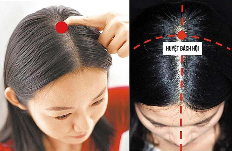 Các huyệt đạo trên đầu có tác dụng gì - Bạn đã biết chưa? 1