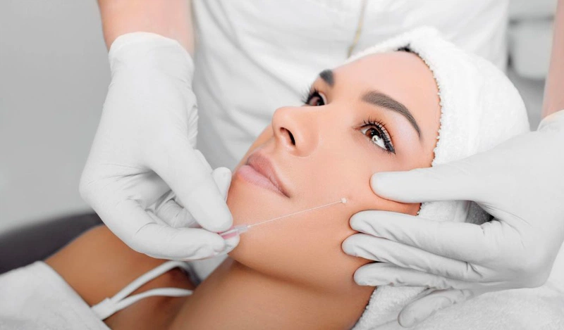 Các phương pháp căng da mặt không phẫu thuật phổ biến hiện nay.