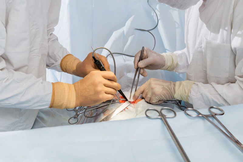 Các phương pháp điều trị bệnh bại não phổ biến 3