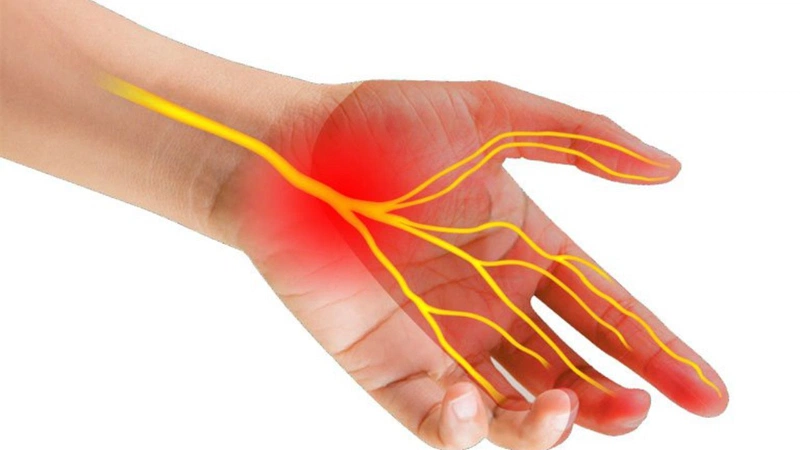 Các phương pháp phẫu thuật hội chứng ống cổ tay 1