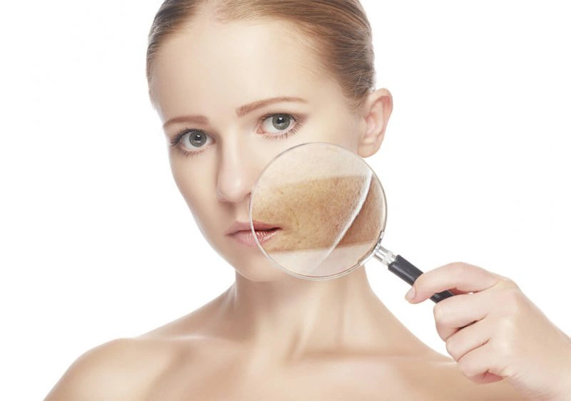 Các phương pháp trị nám bằng thuốc đông y 1