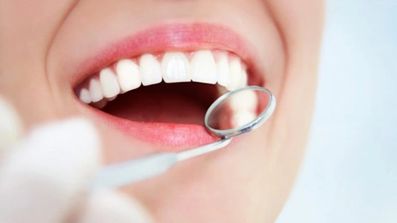 Trám răng giúp phục hồi những chiếc răng bị sâu