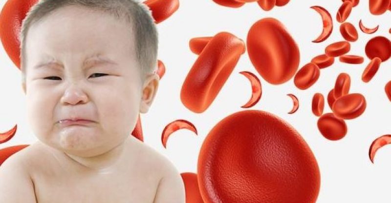 Cách chăm sóc trẻ em mắc bệnh rối loạn đông máu 1