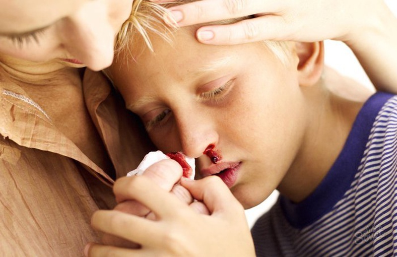 Cách chăm sóc trẻ em mắc bệnh rối loạn đông máu 3