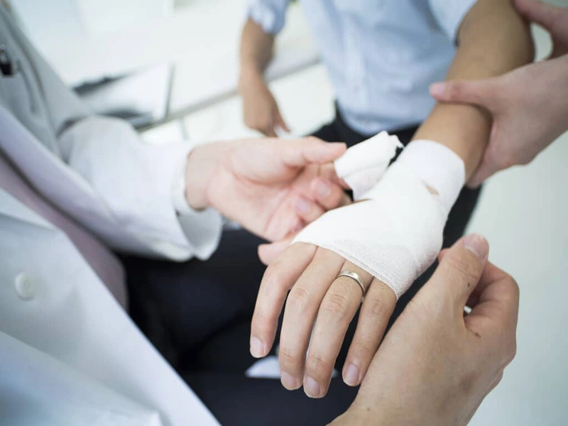 Cách chăm sóc vết bỏng bị vỡ 4