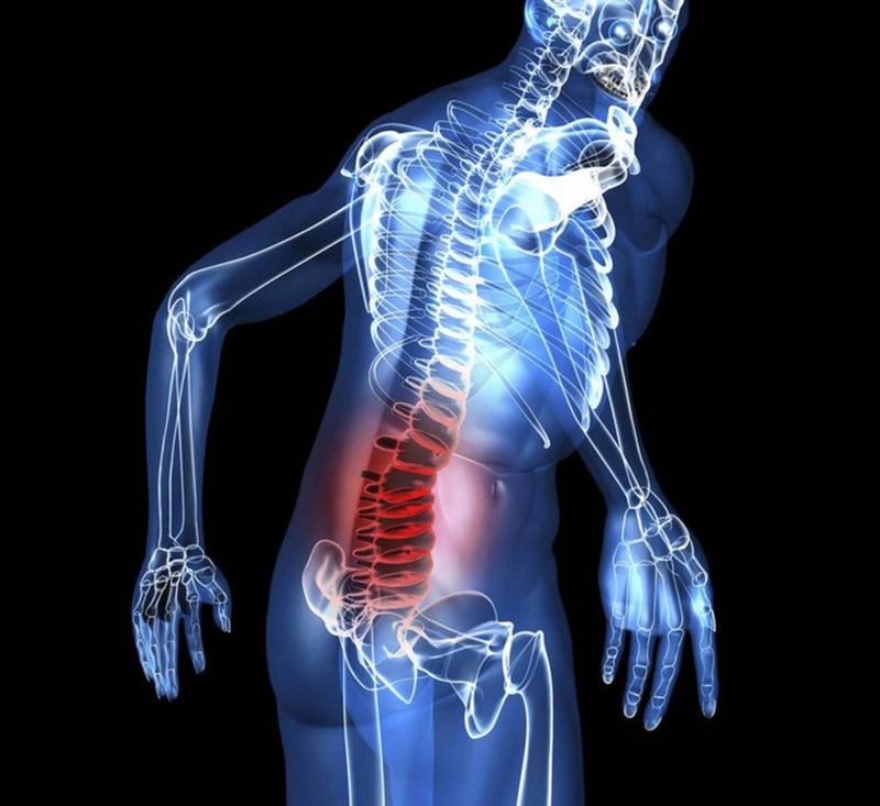 Cách chẩn đoán Sarcoma xương (U xương ác tính) ở trẻ em và thanh thiếu niên 1
