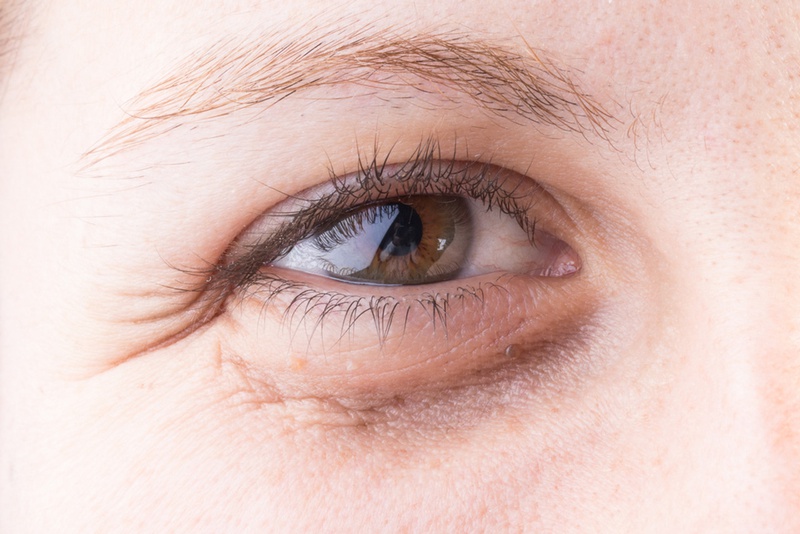 Cách chọn serum trị thâm mắt hiệu quả nhất hiện nay3