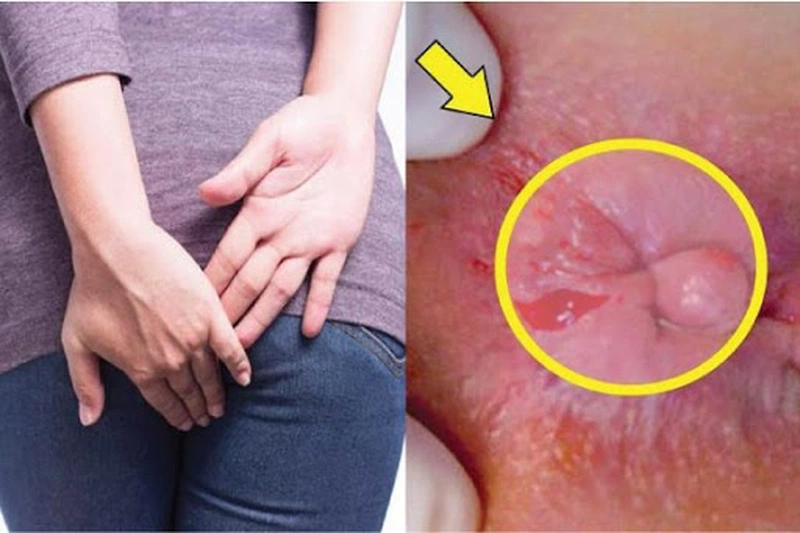 Thuốc Tottri có tốt và hiệu quả không? 3