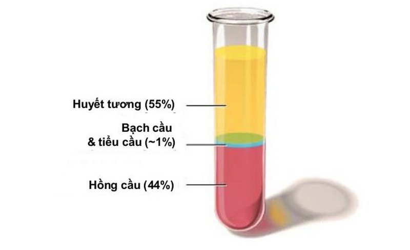 Cách chữa viêm cân gan bàn chân dứt điểm bằng phương pháp huyết tương giàu tiểu cầu (PRP) 4