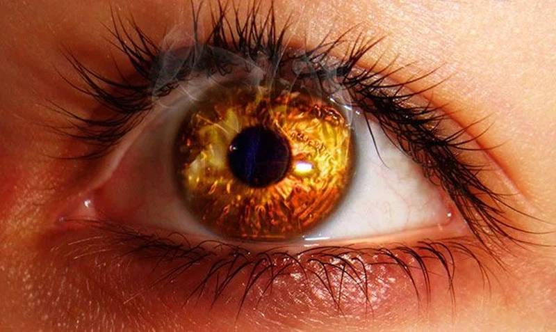 Cách điều trị và sơ cứu bị bỏng mắt hiệu quả nhất 4