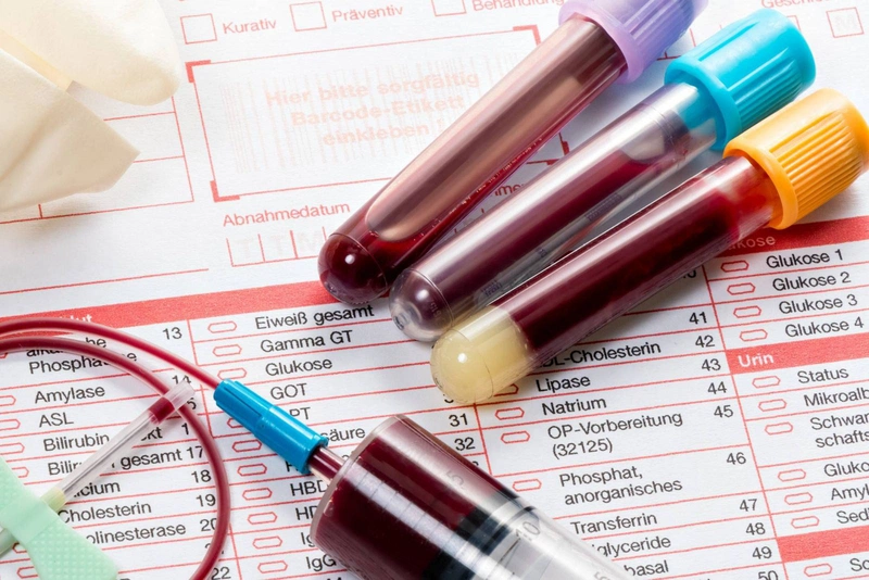 Cách đọc kết quả xét nghiệm máu như thế nào? Kết quả xét nghiệm máu cho biết điều gì? 1