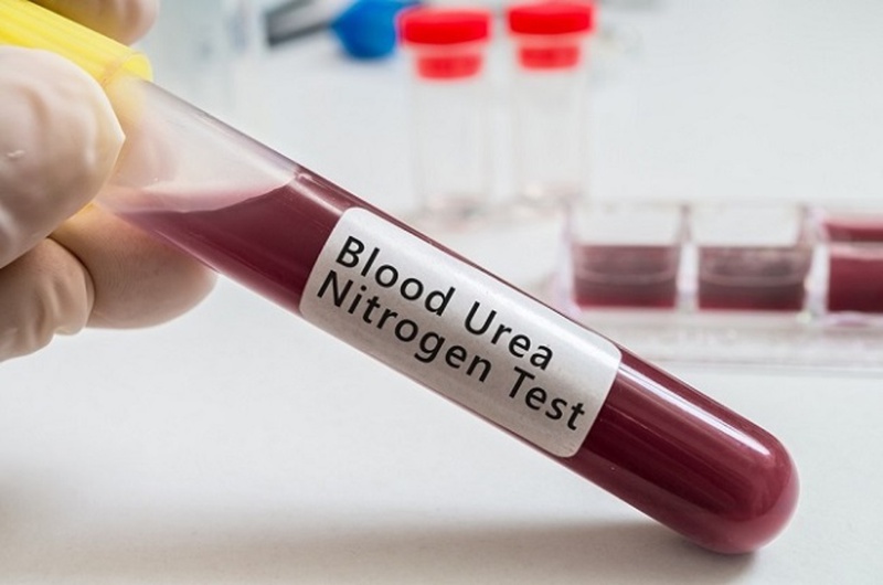Cách đọc kết quả xét nghiệm máu như thế nào? Kết quả xét nghiệm máu cho biết điều gì? 4