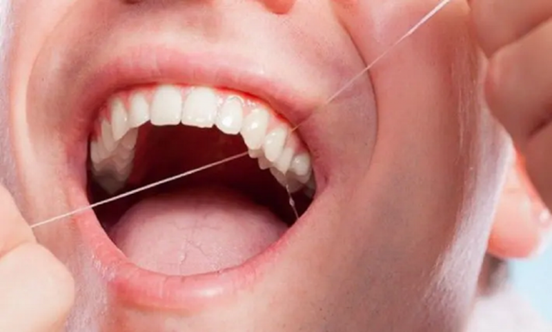 Vệ sinh răng miệng bằng chỉ nha khoa là rất cần thiết
