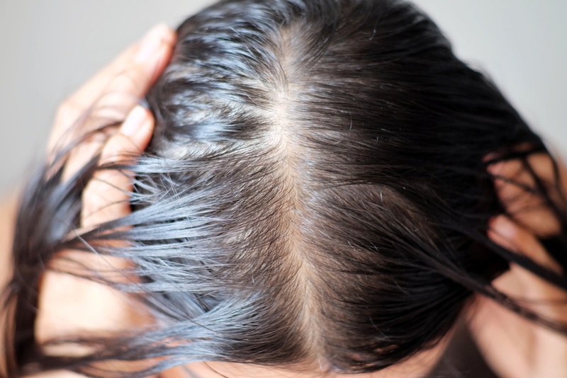 6 cách giúp cho tóc hết bết dính hay nhất